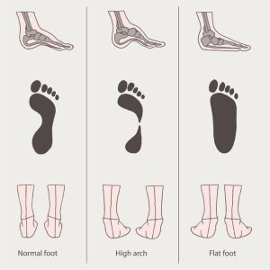 foot pain flat feet podiatrist