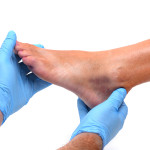 ganglion cyst | Casteel Foot & Ankle Center 972-412-4449