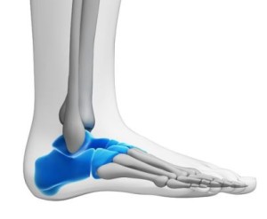 tarsal tunnel syndrome ankle pain