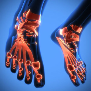 foot xray | Casteel Foot & Ankle Center 972-412-4449